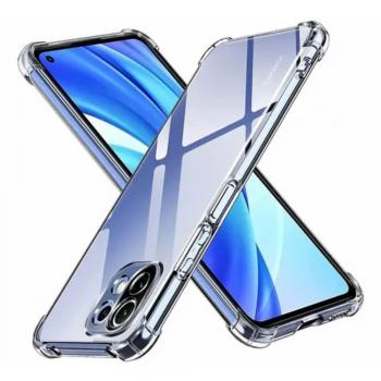 xx_capa-anti-choque-transparente-xiaomi-mi-11-lite-e28cd2094d3f3fafad7c49ede38bf396.jpg